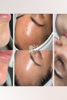 MOLD Manila Redefines Radiance with Science-Based Non-Surgical Aesthetic Care in Quezon City