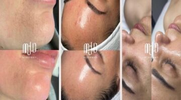 MOLD Manila Redefines Radiance with Science-Based Non-Surgical Aesthetic Care in Quezon City