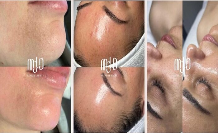 foto slider headline